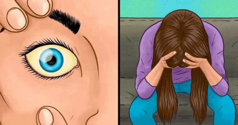 10 signs that your body is suffering from lack of vitamin B12