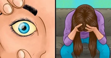 10 signs that your body is suffering from lack of vitamin B12