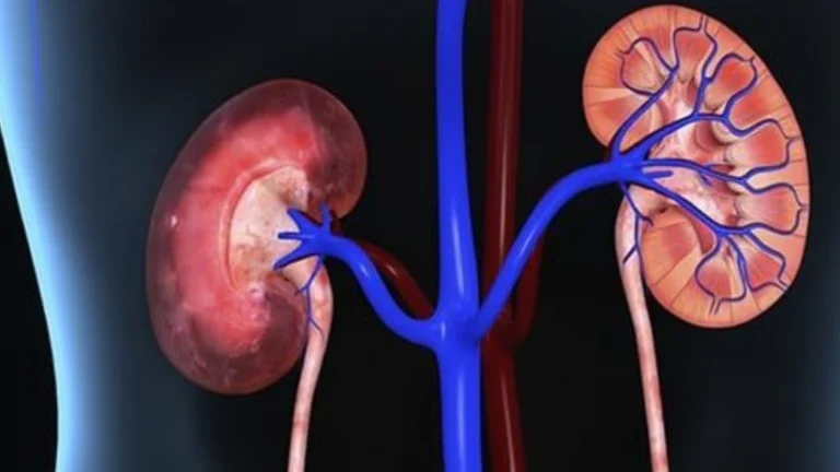 Aliments quotidiens qui peuvent causer des problèmes dans vos reins