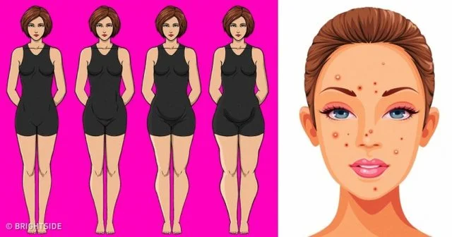 The signs of hormonal disorders that each woman needs to know; from insomnia to sudden rashes