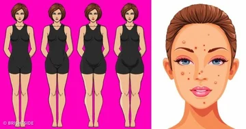 The signs of hormonal disorders that each woman needs to know; from insomnia to sudden rashes