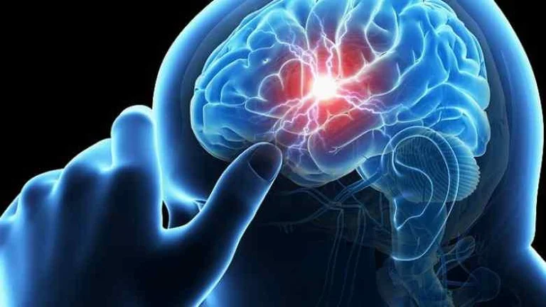 Internationale Epilepsy Day