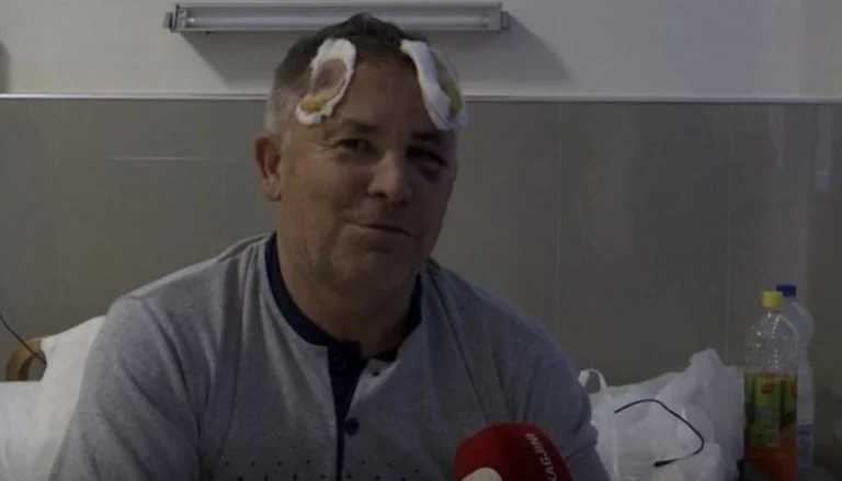 Un poliziotto si fa male mentre era in servizio.