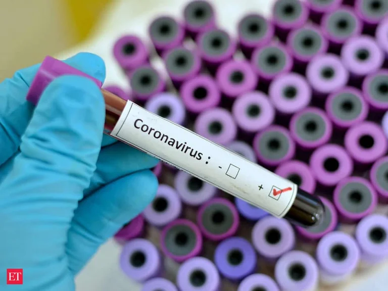 El Instituto de Salud muestra si hay coronario en Kosovo