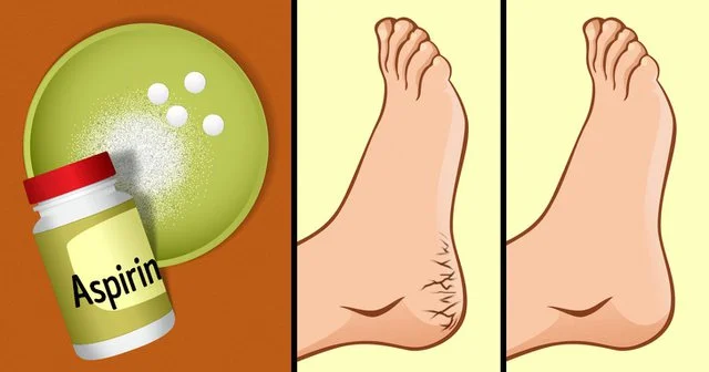 Do you have the heels that crack all year? These are two household products that function 10 times better than expensive creams
