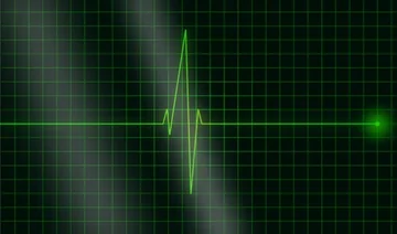 Why the fatal heart attacks on healthy athletes