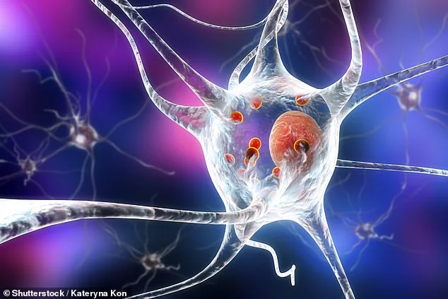 Parkinson can start before birth