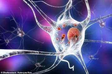 Parkinson può iniziare prima della nascita