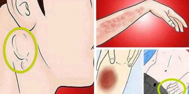 Learn about the signs that cancer is reaching “very much in your body
