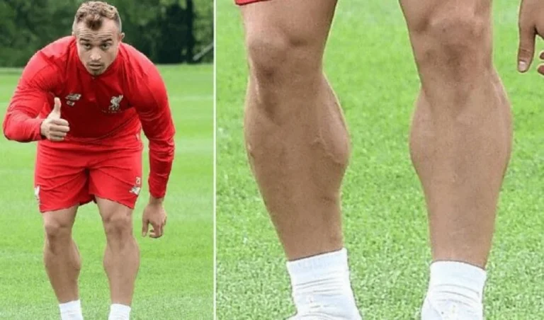Clopp für Shaqiri: Er ist ganz anders als die anderen. Ich habe nie etwas wie es gesehen.