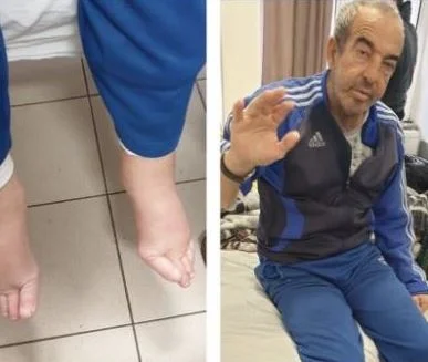 Faik Vuçitërna nga Rahoveci ka nevojë urgjente për ndihmën tuaj