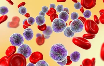 The silent symptoms of leukemia that you should never ignore