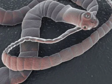 Doctors found hundreds of worms in the brain, caused by the consumption of more popular food