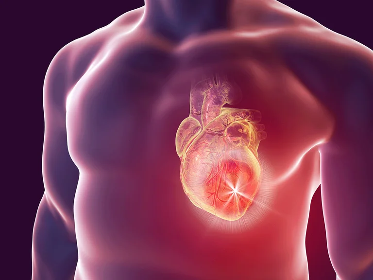 Nehmen Sie diesen Test und verstehen, wie gesund Ihr Herz ist