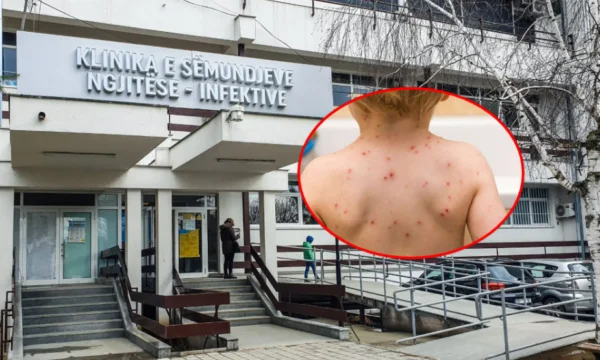 Ten cases of measles, QKUK-Princes: Don't fall prey to deninforms, vaccinate children, risk of disease is great