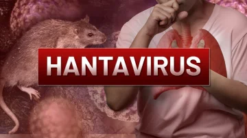 OBS Director Hantavirus is no other COVID, its risk remains low