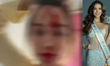 Blood-covered face, beaten “Miss Venezuela”, arrested known designer