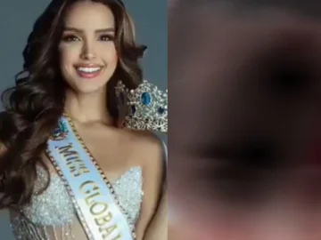 Fytyra e mbuluar me gjak, rrahet “Miss Venezuela”, arrestohet stilisti i njohur