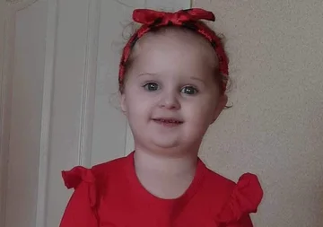 Etats-Unis: 3 ans perd sa vie dans les poux, les parents ont laissé l'infection se transformer en anémie