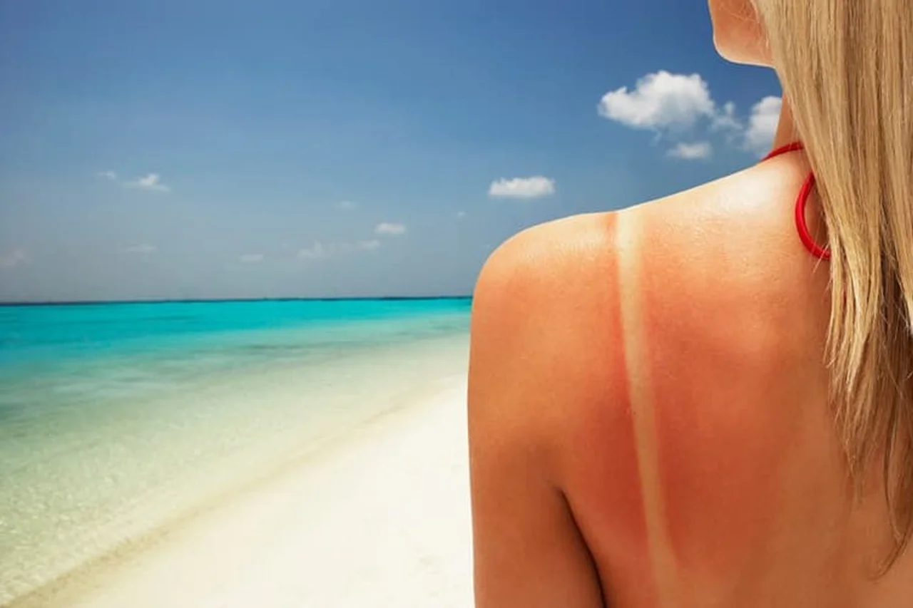 kujdesi-dermatologjik-ne-vere-si-te-mbrojme-lekuren-nga-demtimet-e-diellit