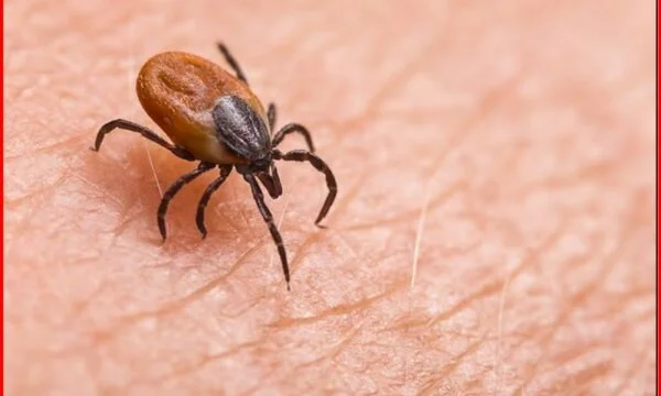 Anzeichen dafür, dass das Stichen eines Insekts ernster sein kann als offensichtlich
